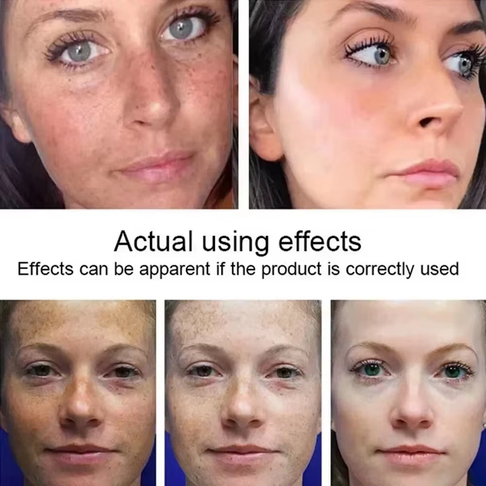 GlowFade™ Spotless Radiance Skin Brightening Serum