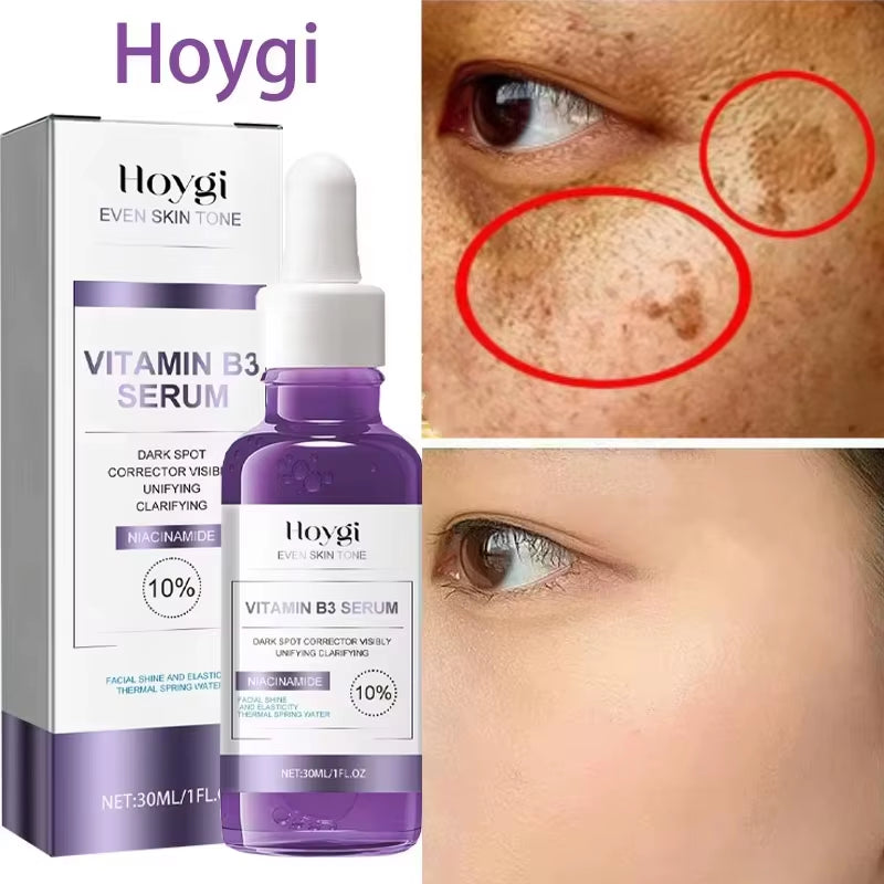 GlowFade™ Spotless Radiance Skin Brightening Serum